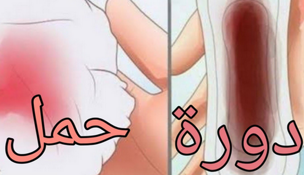 شكل دم الحمل بالصور